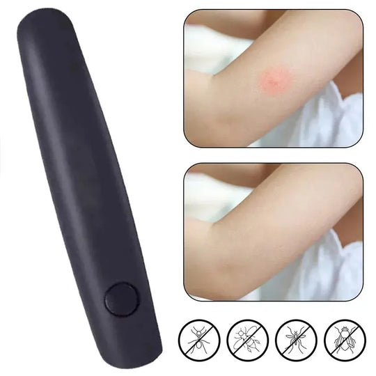 Para picazón, picadura, insecto, mosquito, bolígrafo portátil, negro, alivia los niños adultos, antipicazón físico, palo para dejar de picazón, antipruriginoso MedSurgery Store For Digital Health